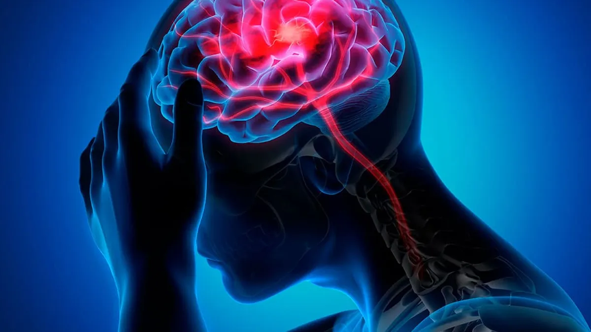 Advierten que la migraña es una enfermedad discapacitante y subdiagnosticada
